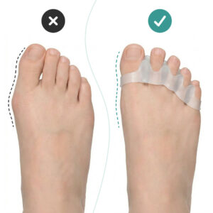 Alternative view of OrthoRelax® – Separator pentru Degete din Gel (2 separatori)