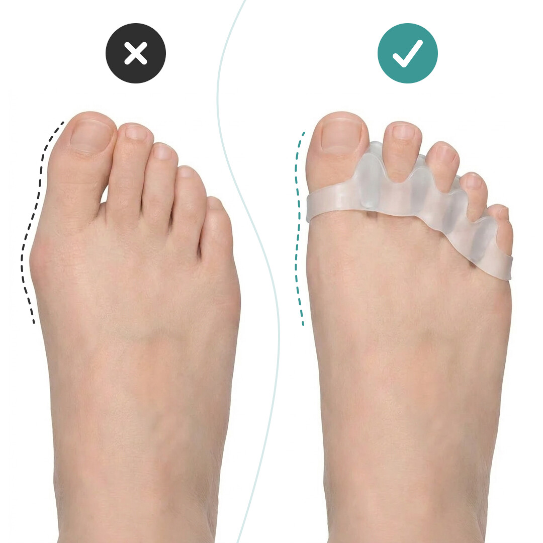 OrthoRelax® – Separator pentru Degete din Gel (2 separatori) - imagine 2