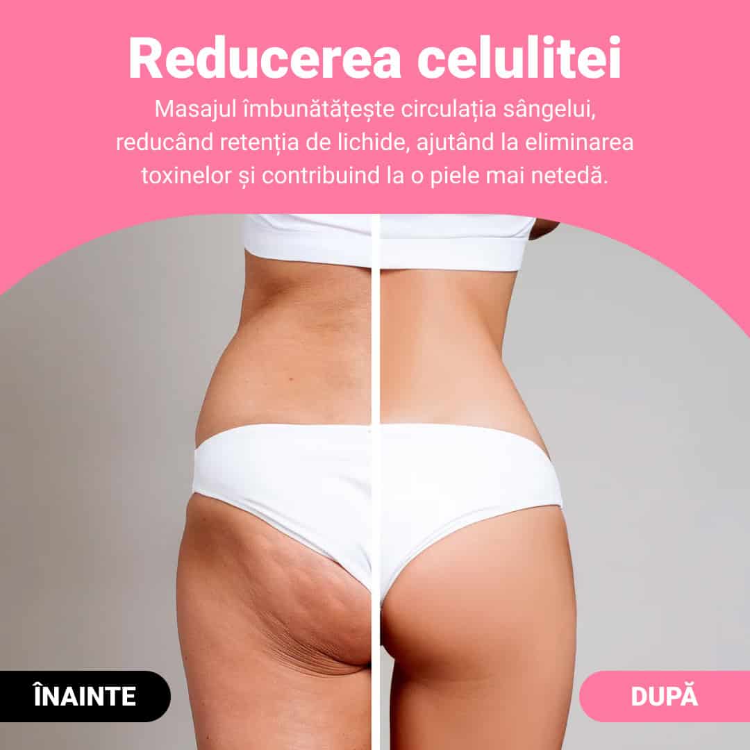 GUASHA – rolă de masaj pentru remodelarea corpului și reducerea vizibilă a celulitei și grăsimii - imagine 2